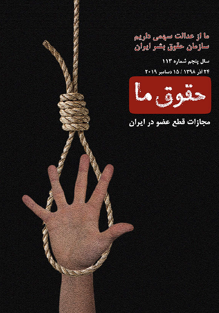 شماره ۱۱۳؛ «مجازات»ی به نام قطع عضو