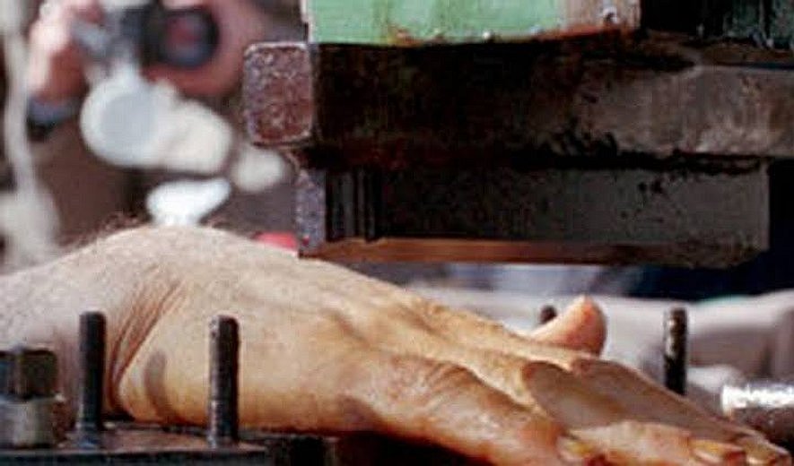 Iran Human Rights Article Iranian authorities cut off a man's hand