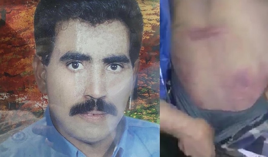 نیاز فوری برای تشکیل کمیسیون حقیقت‌یاب در خصوص مرگ یک زندانی زیر شکنجه