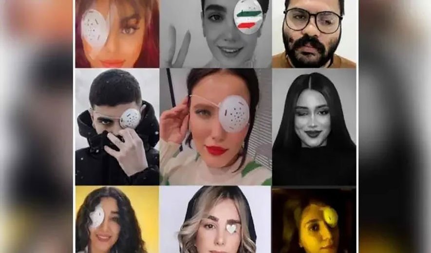 شلیک به چشم‌ها؛ تلاش نافرجام حکومت ایران  برای وحشت افکنی